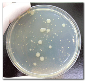 Usp Microbial Enumeration Test Microchem Laboratory